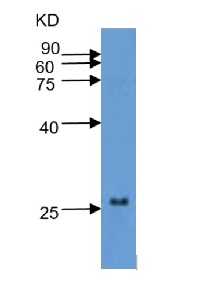 WRKY10 transcription factor in the group Antibodies for Plant/Algal / DNA/RNA/Cell Cycle / Transcription regulation at Agrisera AB (Antibodies for research) (AS16 3851)